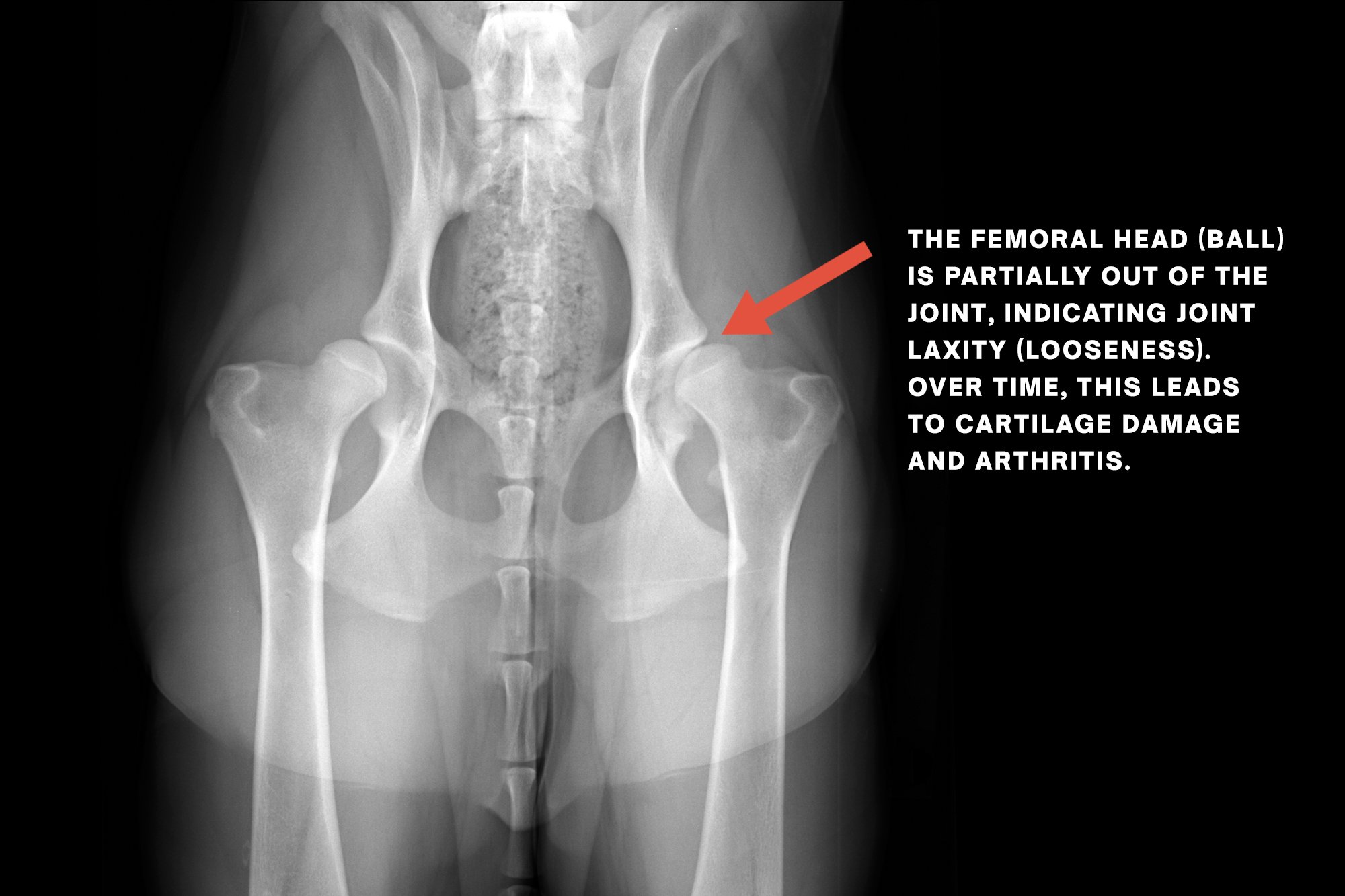 Hip-Before-Bio