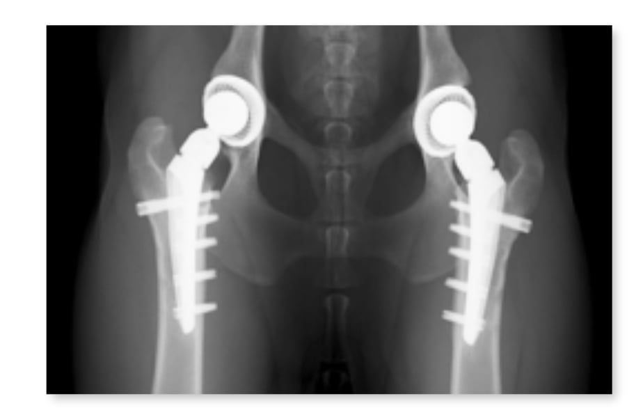 KYON Total Hip Picture of Impant