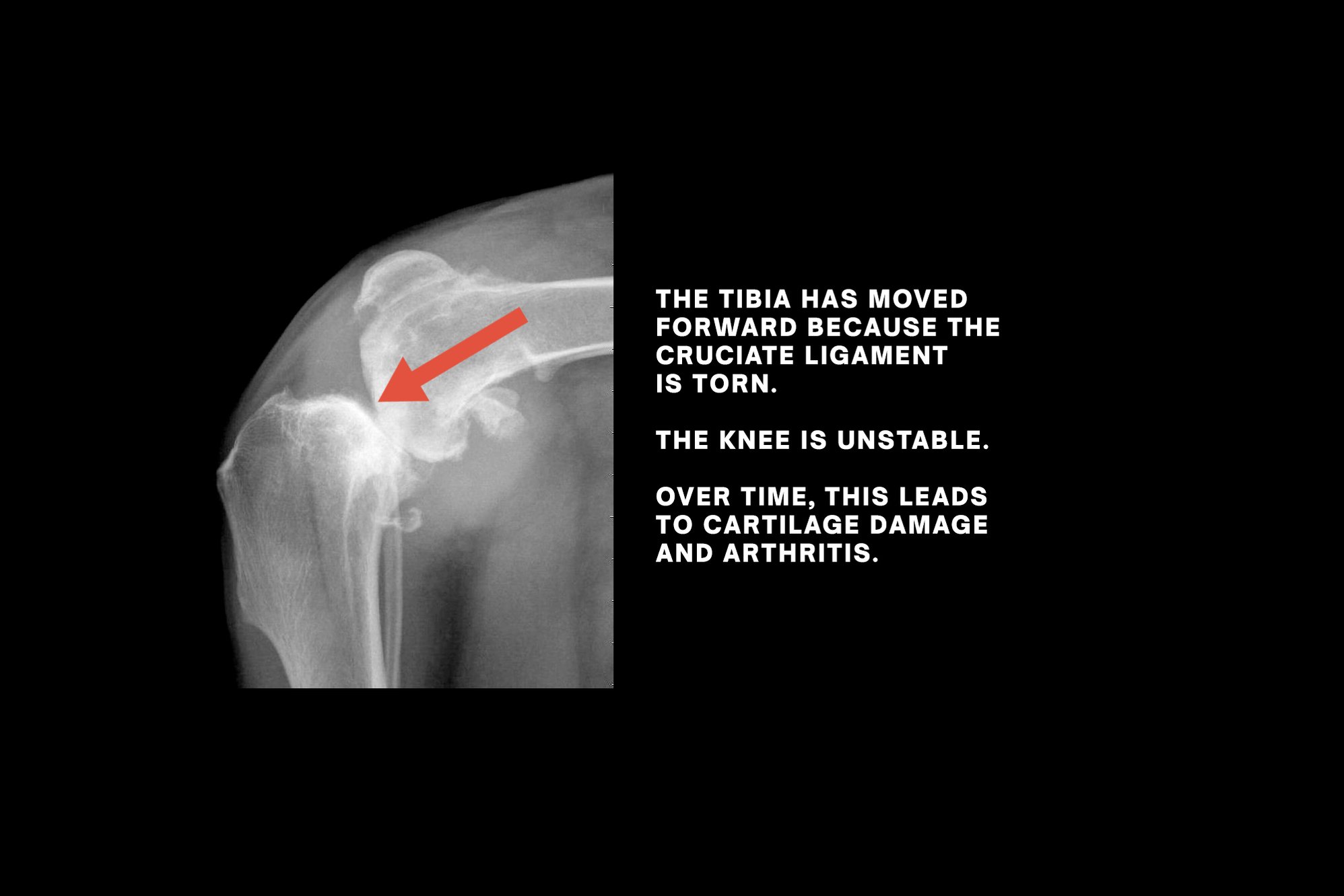 Radiograph--Knee-Before
