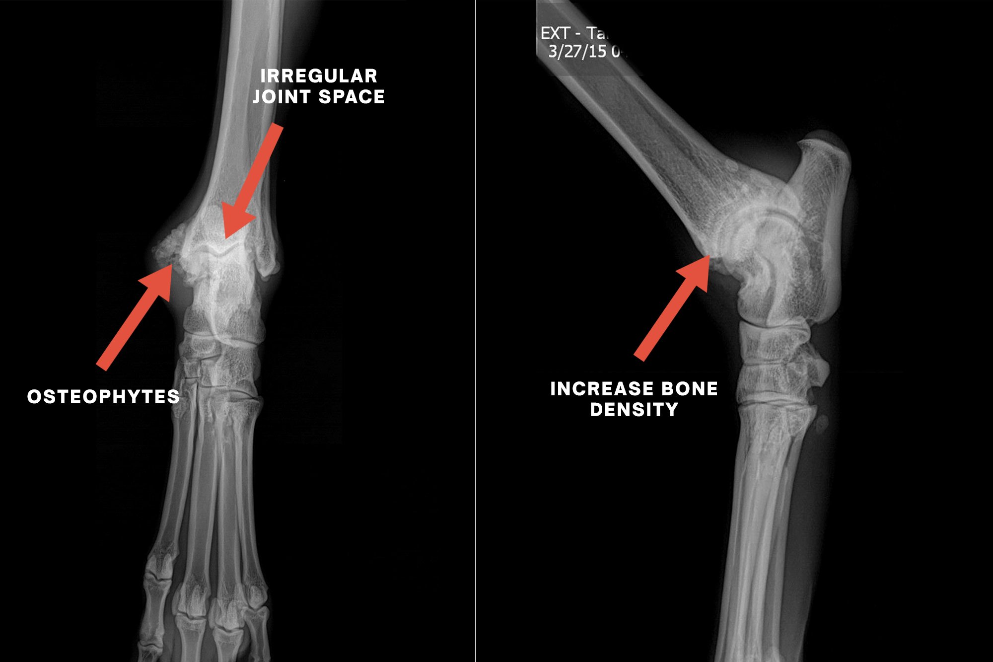 Radiograph-1