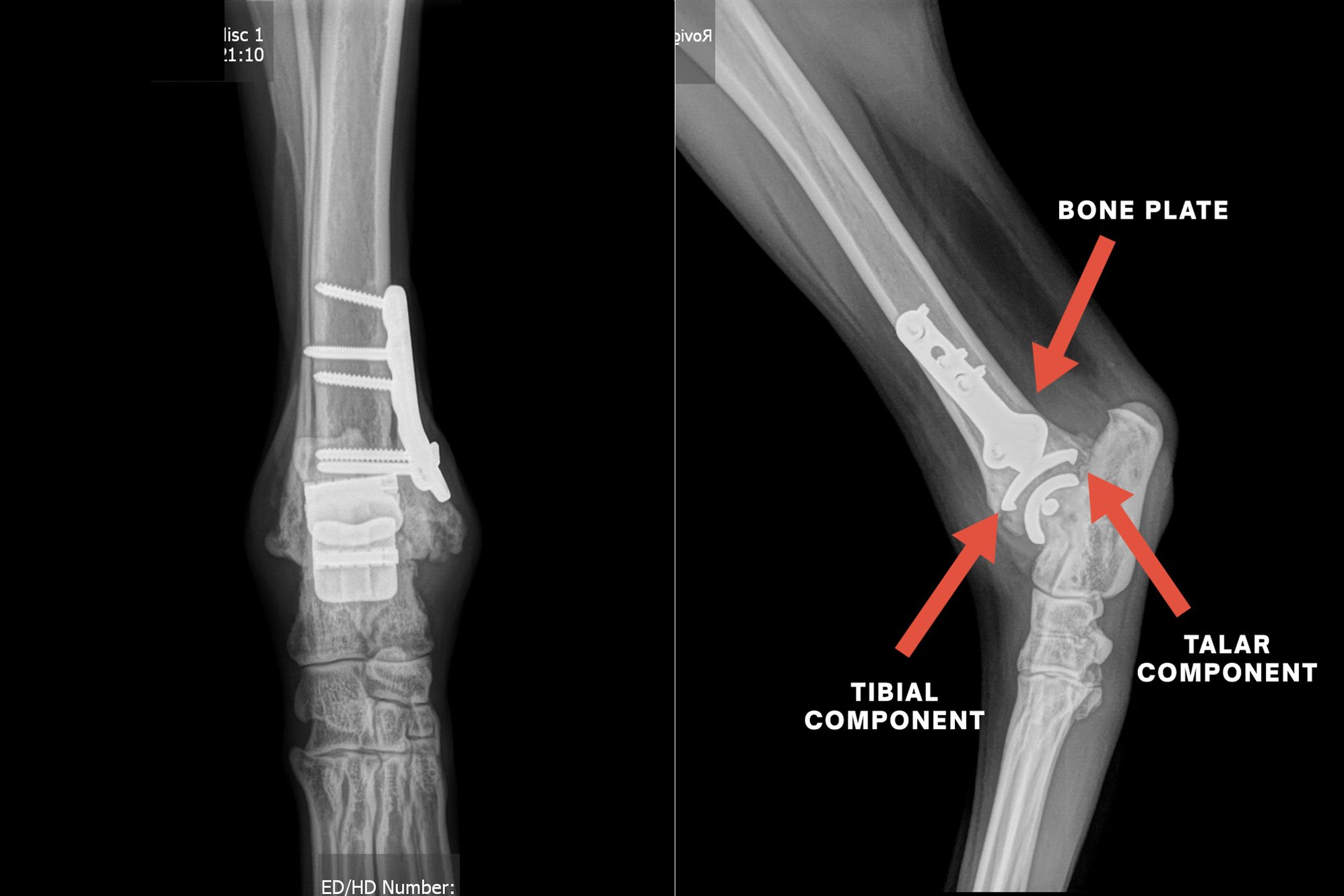 Radiograph-2